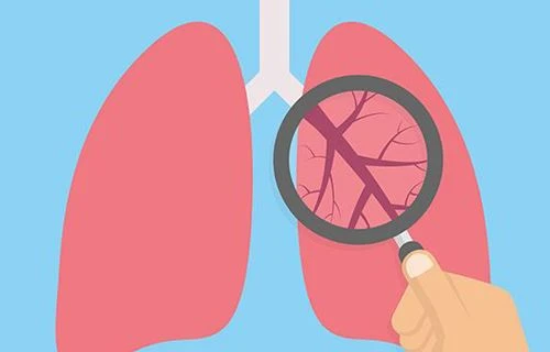 Enkonpreyansyon nan terapi oksijèn nan COPD